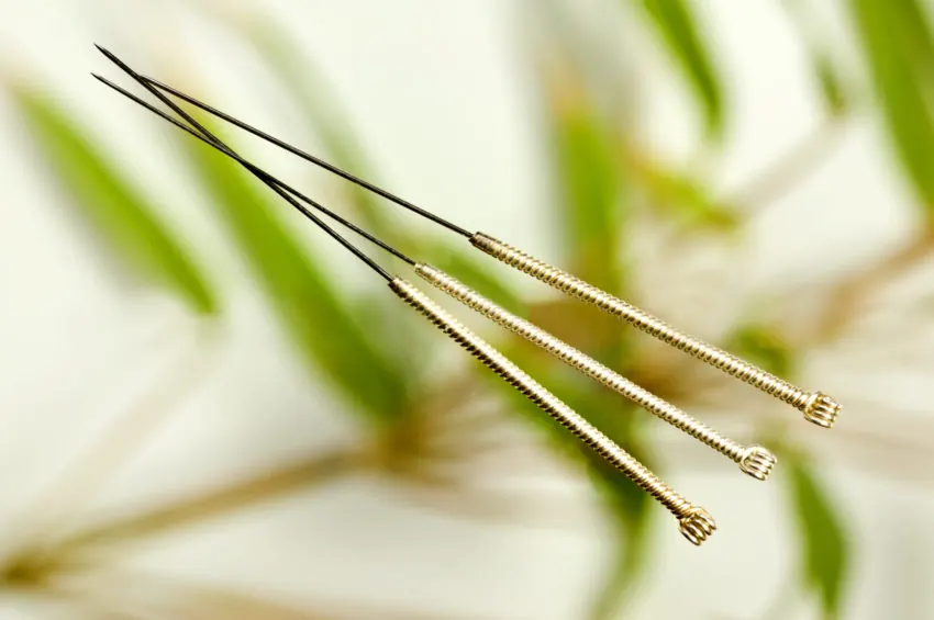 Acupuncture for Health and Wellness